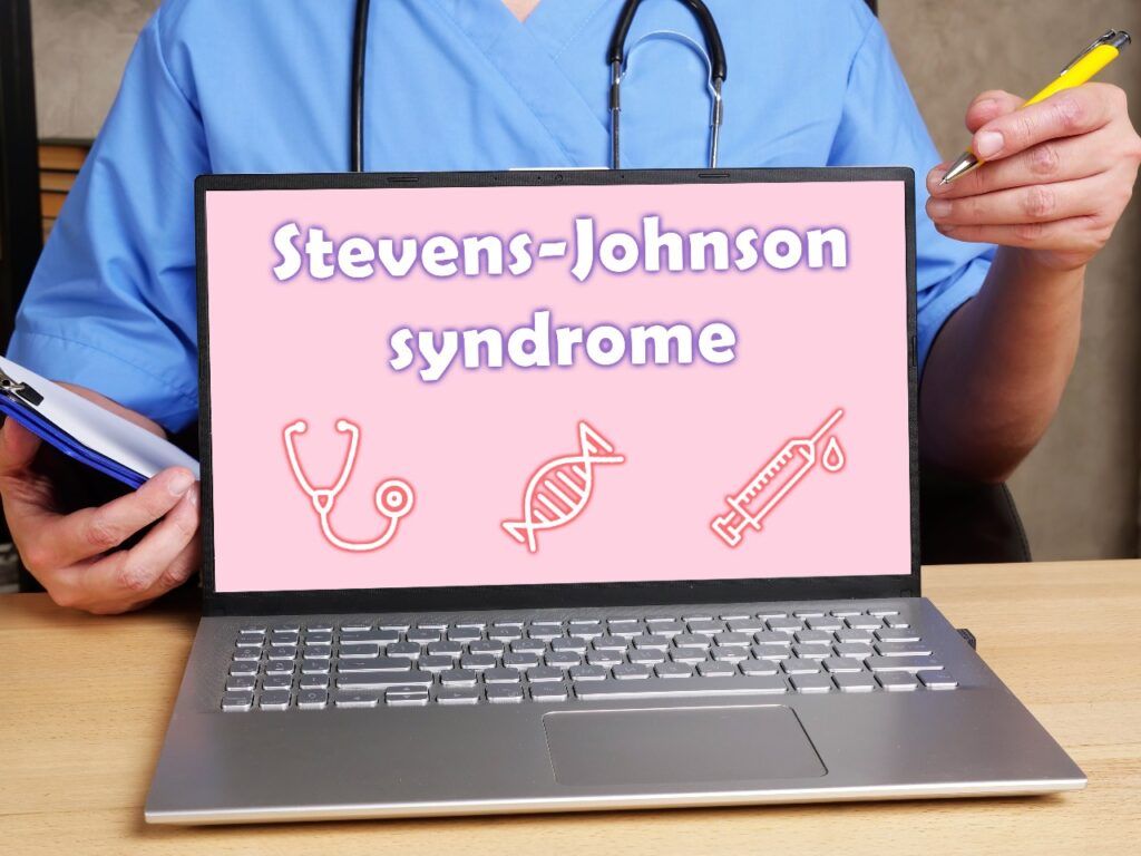 Stevens-Johnson syndrome phrase on computer screen